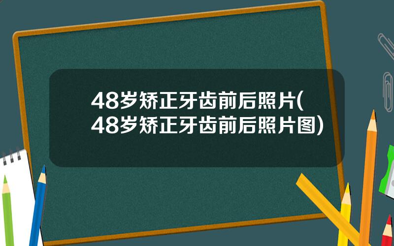 48岁矫正牙齿前后照片(48岁矫正牙齿前后照片图)