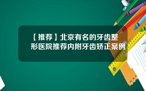 【推荐】北京有名的牙齿整形医院推荐内附牙齿矫正案例