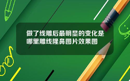 做了线雕后最明显的变化是哪里雕线隆鼻图片效果图