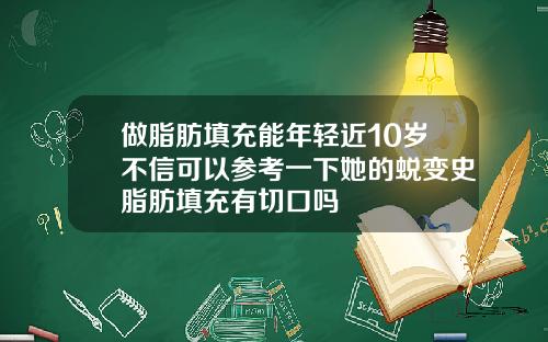 做脂肪填充能年轻近10岁不信可以参考一下她的蜕变史脂肪填充有切口吗