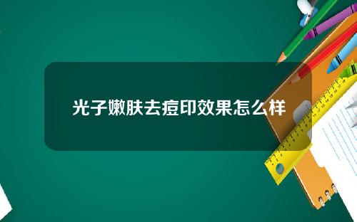 光子嫩肤去痘印效果怎么样