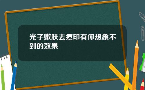 光子嫩肤去痘印有你想象不到的效果