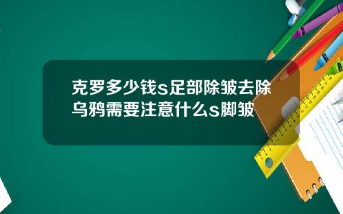 克罗多少钱s足部除皱去除乌鸦需要注意什么s脚皱
