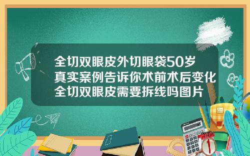 全切双眼皮外切眼袋50岁真实案例告诉你术前术后变化全切双眼皮需要拆线吗图片