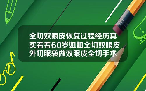 全切双眼皮恢复过程经历真实看看60岁姐姐全切双眼皮外切眼袋做双眼皮全切手术