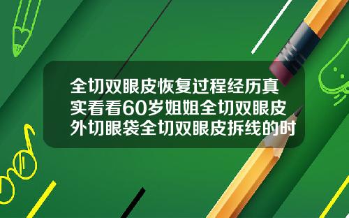 全切双眼皮恢复过程经历真实看看60岁姐姐全切双眼皮外切眼袋全切双眼皮拆线的时候可以修复吗