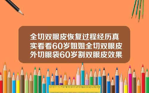 全切双眼皮恢复过程经历真实看看60岁姐姐全切双眼皮外切眼袋60岁割双眼皮效果图