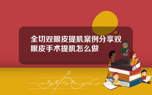 全切双眼皮提肌案例分享双眼皮手术提肌怎么做