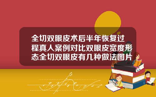全切双眼皮术后半年恢复过程真人案例对比双眼皮宽度形态全切双眼皮有几种做法图片