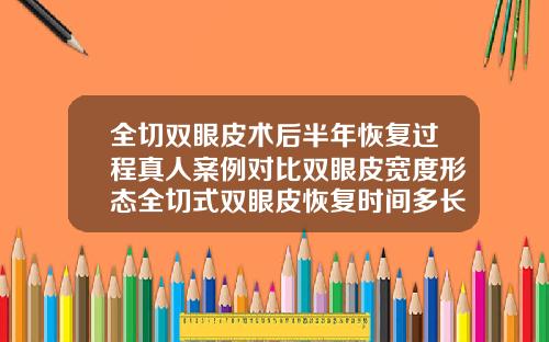 全切双眼皮术后半年恢复过程真人案例对比双眼皮宽度形态全切式双眼皮恢复时间多长
