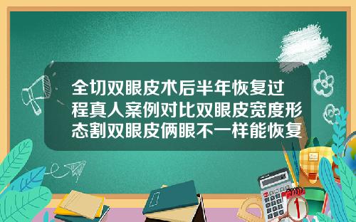 全切双眼皮术后半年恢复过程真人案例对比双眼皮宽度形态割双眼皮俩眼不一样能恢复过来吗