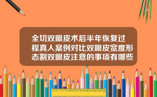 全切双眼皮术后半年恢复过程真人案例对比双眼皮宽度形态割双眼皮注意的事项有哪些图片