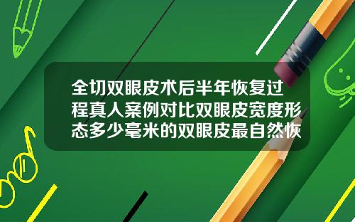 全切双眼皮术后半年恢复过程真人案例对比双眼皮宽度形态多少毫米的双眼皮最自然恢复