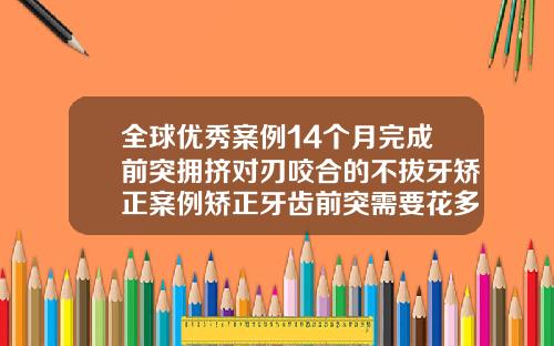 全球优秀案例14个月完成前突拥挤对刃咬合的不拔牙矫正案例矫正牙齿前突需要花多钱