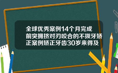 全球优秀案例14个月完成前突拥挤对刃咬合的不拔牙矫正案例矫正牙齿30岁来得及吗
