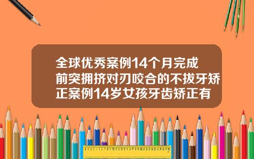 全球优秀案例14个月完成前突拥挤对刃咬合的不拔牙矫正案例14岁女孩牙齿矫正有必要拔牙吗
