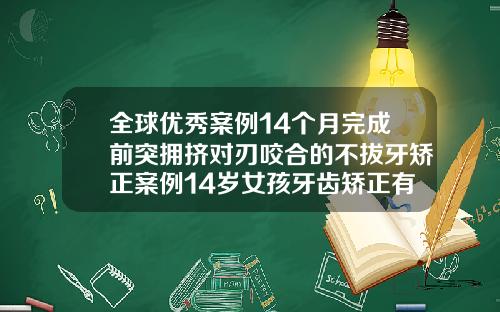 全球优秀案例14个月完成前突拥挤对刃咬合的不拔牙矫正案例14岁女孩牙齿矫正有必要拔牙吗