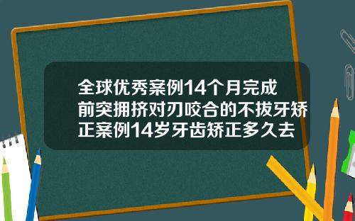 全球优秀案例14个月完成前突拥挤对刃咬合的不拔牙矫正案例14岁牙齿矫正多久去一次