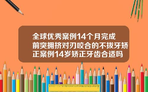 全球优秀案例14个月完成前突拥挤对刃咬合的不拔牙矫正案例14岁矫正牙齿合适吗