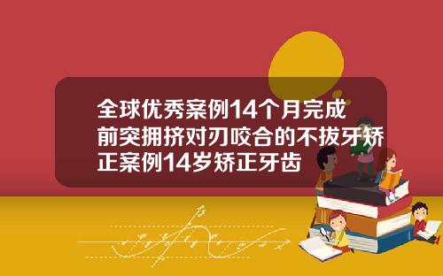全球优秀案例14个月完成前突拥挤对刃咬合的不拔牙矫正案例14岁矫正牙齿