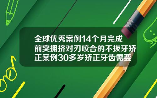 全球优秀案例14个月完成前突拥挤对刃咬合的不拔牙矫正案例30多岁矫正牙齿需要多久