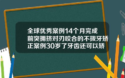 全球优秀案例14个月完成前突拥挤对刃咬合的不拔牙矫正案例30岁了牙齿还可以矫正吗图片