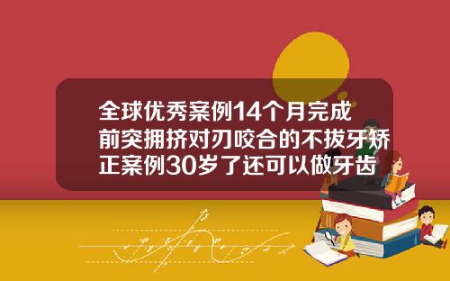 全球优秀案例14个月完成前突拥挤对刃咬合的不拔牙矫正案例30岁了还可以做牙齿矫正