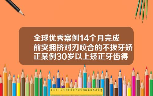 全球优秀案例14个月完成前突拥挤对刃咬合的不拔牙矫正案例30岁以上矫正牙齿得多长时间