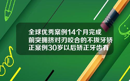 全球优秀案例14个月完成前突拥挤对刃咬合的不拔牙矫正案例30岁以后矫正牙齿有用吗