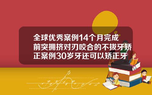 全球优秀案例14个月完成前突拥挤对刃咬合的不拔牙矫正案例30岁牙还可以矫正牙齿吗