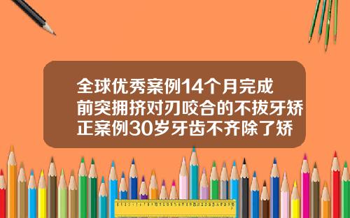 全球优秀案例14个月完成前突拥挤对刃咬合的不拔牙矫正案例30岁牙齿不齐除了矫正还有什么办法改善