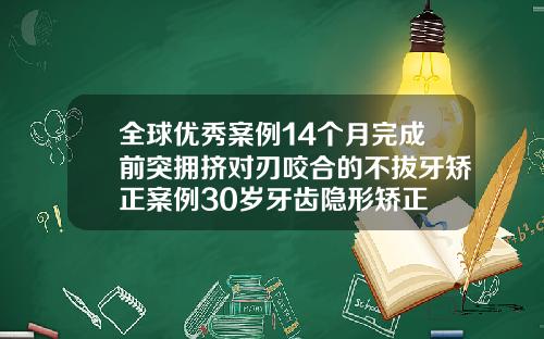 全球优秀案例14个月完成前突拥挤对刃咬合的不拔牙矫正案例30岁牙齿隐形矫正