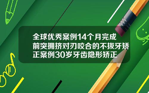 全球优秀案例14个月完成前突拥挤对刃咬合的不拔牙矫正案例30岁牙齿隐形矫正