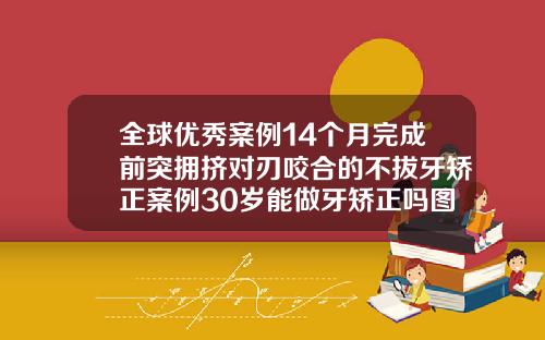 全球优秀案例14个月完成前突拥挤对刃咬合的不拔牙矫正案例30岁能做牙矫正吗图片