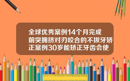 全球优秀案例14个月完成前突拥挤对刃咬合的不拔牙矫正案例30岁能矫正牙齿会使牙齿松动吗