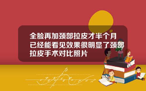 全脸再加颈部拉皮才半个月已经能看见效果很明显了颈部拉皮手术对比照片