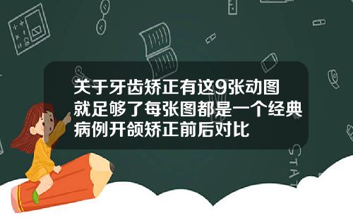 关于牙齿矫正有这9张动图就足够了每张图都是一个经典病例开颌矫正前后对比