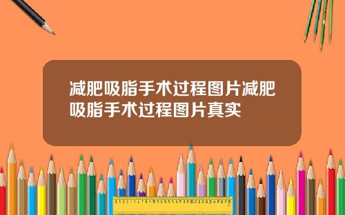 减肥吸脂手术过程图片减肥吸脂手术过程图片真实