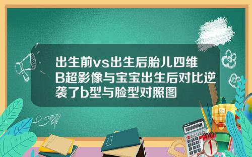 出生前vs出生后胎儿四维B超影像与宝宝出生后对比逆袭了b型与脸型对照图