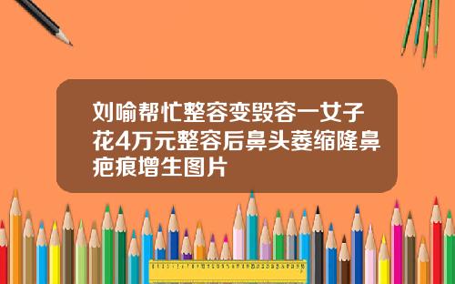 刘喻帮忙整容变毁容一女子花4万元整容后鼻头萎缩隆鼻疤痕增生图片