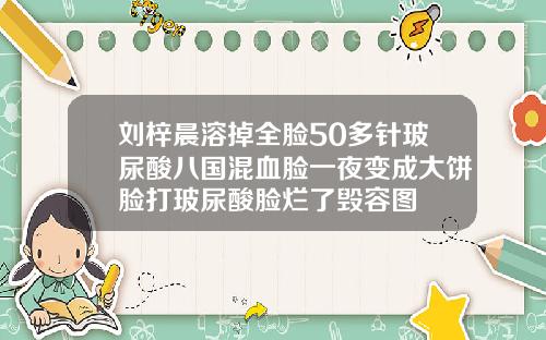 刘梓晨溶掉全脸50多针玻尿酸八国混血脸一夜变成大饼脸打玻尿酸脸烂了毁容图
