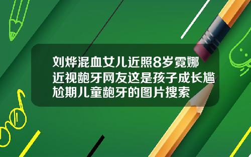刘烨混血女儿近照8岁霓娜近视龅牙网友这是孩子成长尴尬期儿童龅牙的图片搜索