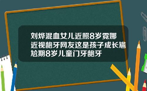 刘烨混血女儿近照8岁霓娜近视龅牙网友这是孩子成长尴尬期8岁儿童门牙龅牙
