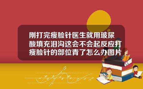刚打完瘦脸针医生就用玻尿酸填充泪沟这会不会起反应打瘦脸针的部位青了怎么办图片
