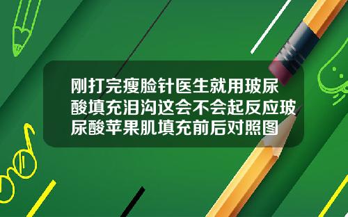 刚打完瘦脸针医生就用玻尿酸填充泪沟这会不会起反应玻尿酸苹果肌填充前后对照图