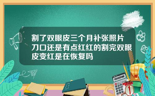 割了双眼皮三个月补张照片刀口还是有点红红的割完双眼皮变红是在恢复吗