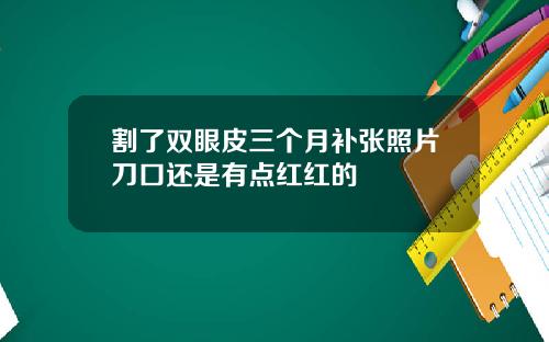 割了双眼皮三个月补张照片刀口还是有点红红的
