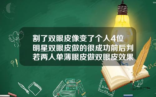 割了双眼皮像变了个人4位明星双眼皮做的很成功前后判若两人单薄眼皮做双眼皮效果