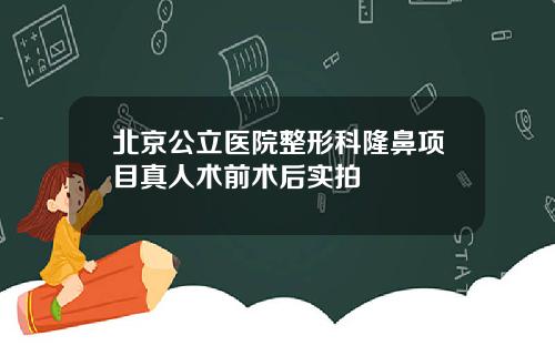 北京公立医院整形科隆鼻项目真人术前术后实拍