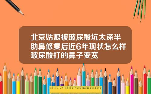 北京姑娘被玻尿酸坑太深半肋鼻修复后近6年现状怎么样玻尿酸打的鼻子变宽